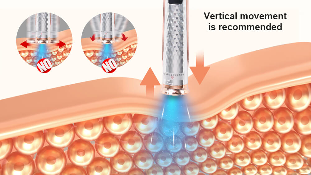 Electric Microneedling Pen