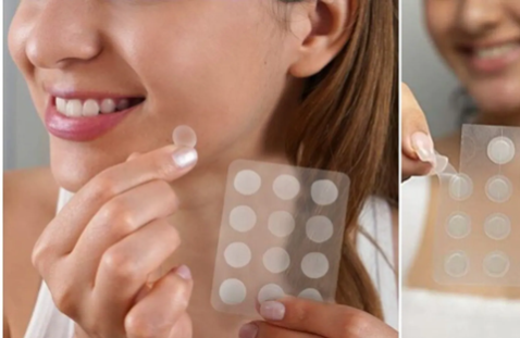 New fashion trend! Acne patch!