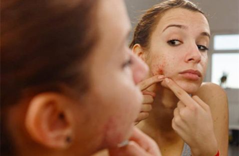 Oily  Here! The Secret To Oil Control, Acne Breakouts And A Refreshing Summer